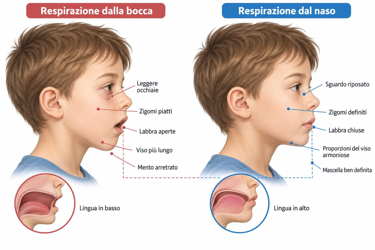 Illustrazione di profilo: viso allungato con bocca aperta e mento arretrato, e viso armonioso con labbra chiuse e mandibola definita